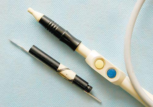 国产氩气刀介绍视频,创新医疗设备，引领微创手术新篇章